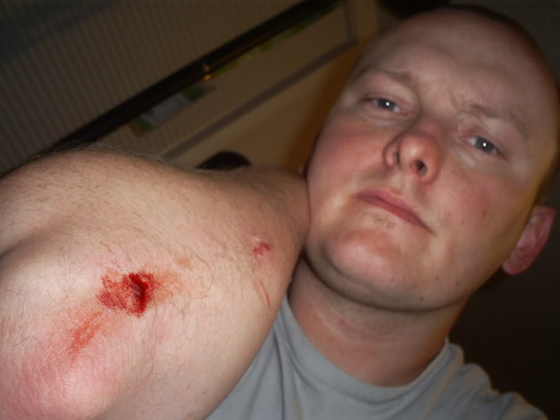 Name:  ouch.jpg
Views: 33
Size:  86.3 KB