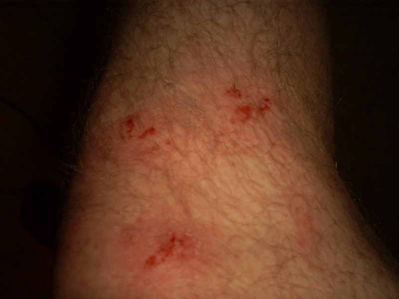 Name:  Leg.jpg
Views: 32
Size:  76.8 KB