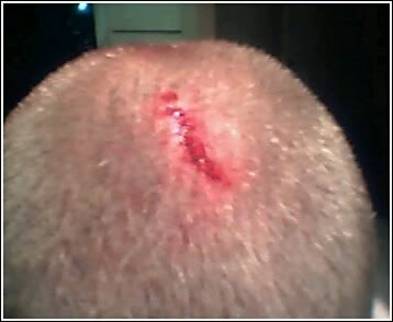 Name:  head1.jpg
Views: 18
Size:  13.2 KB